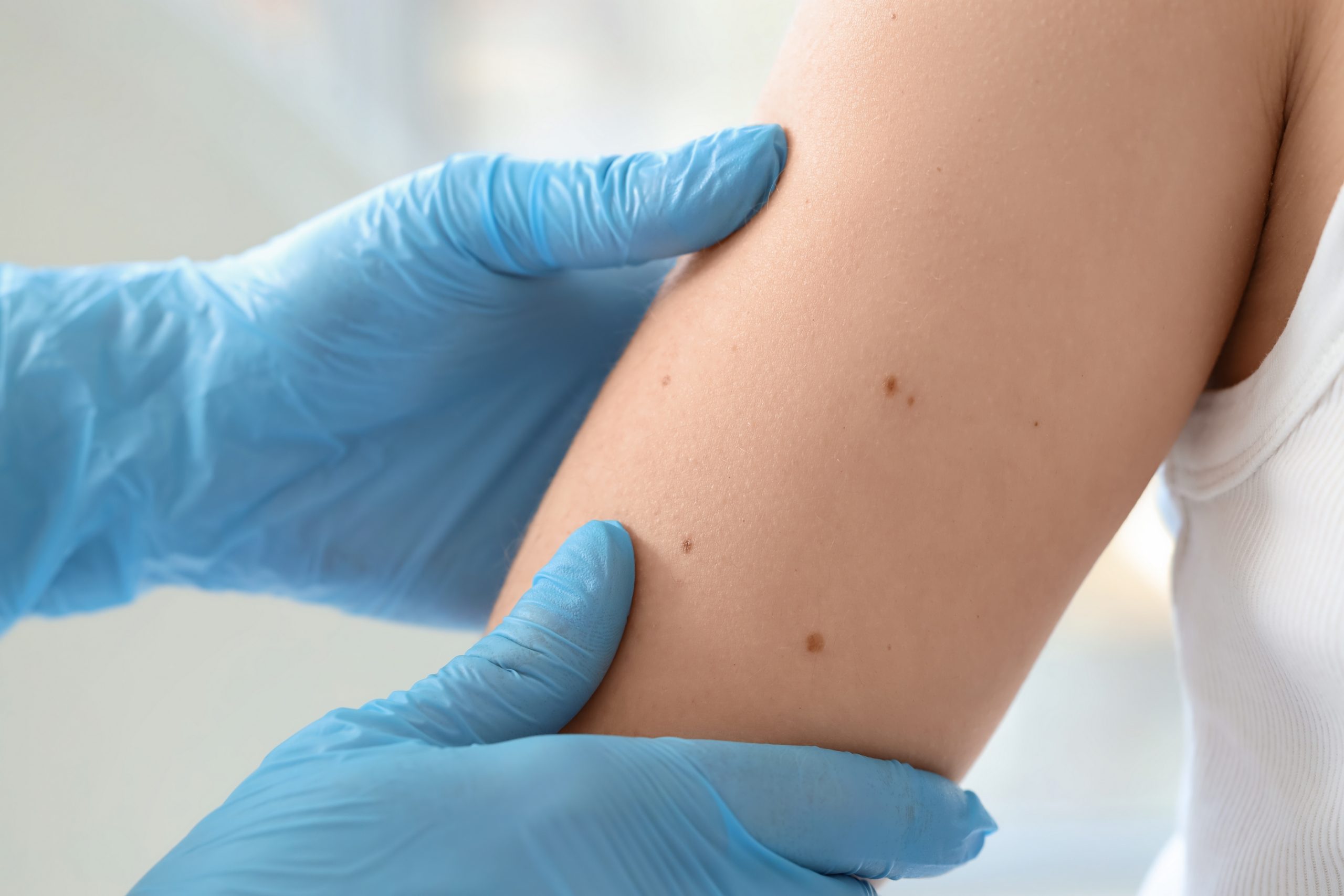 consultatii dermatologie venerologie